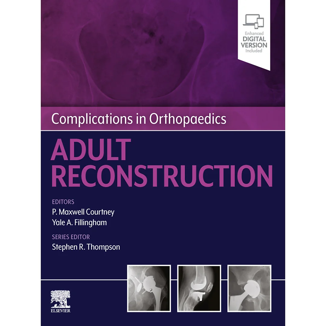 Complications in Orthopaedics: Adult Reconstruction - E-Book
