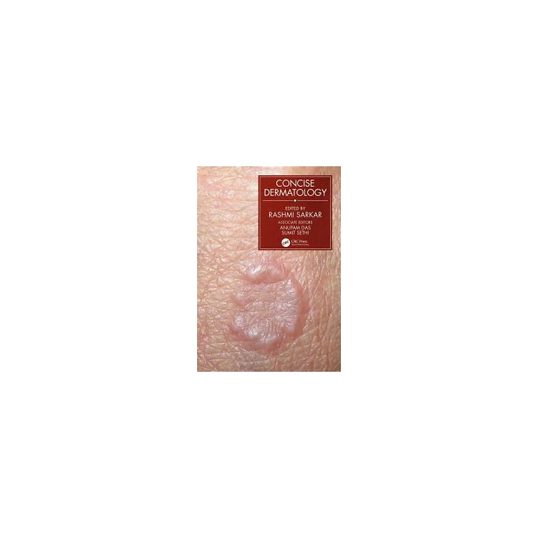 Concise Dermatology