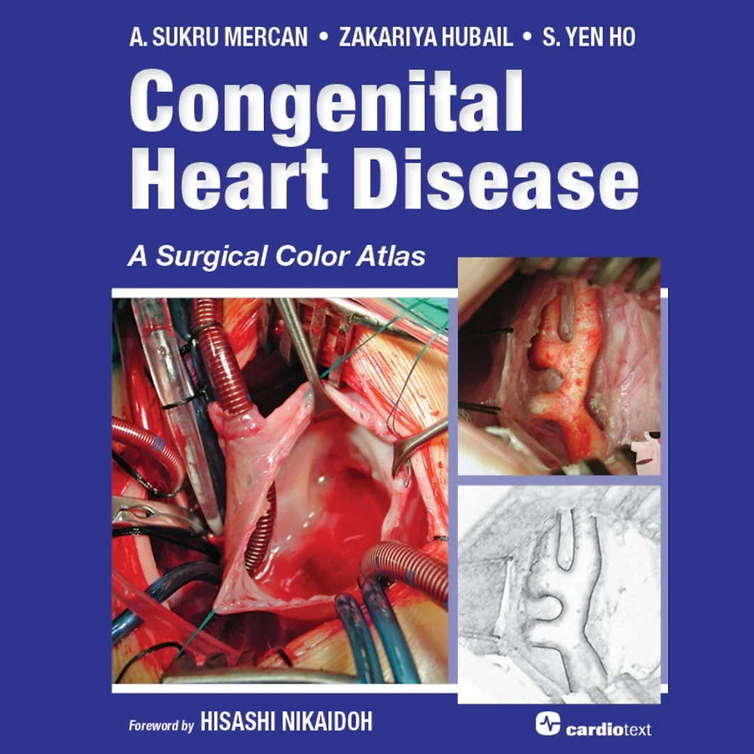 Congenital Heart Disease: A Surgical Color Atlas: A Surgical Color Atlas