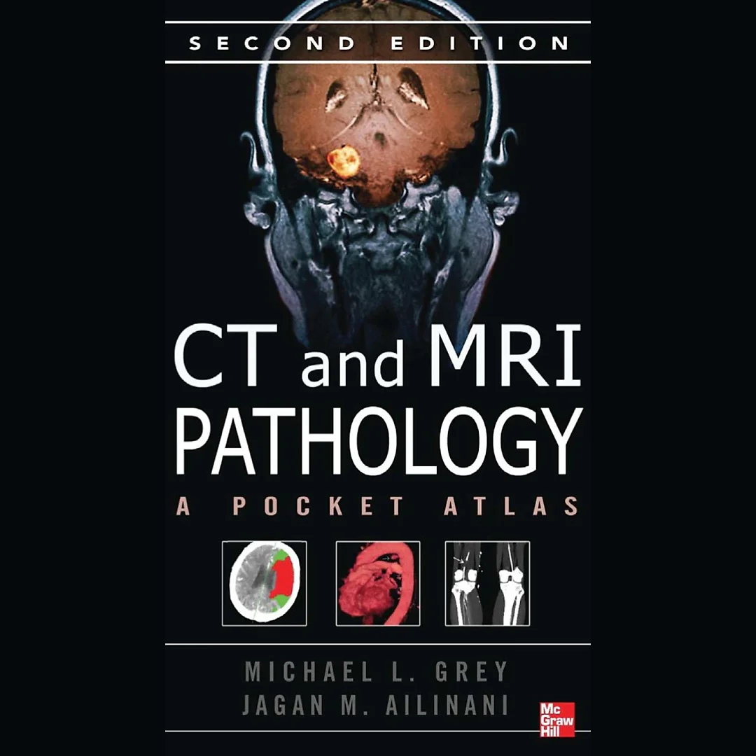 CT & MRI Pathology: A Pocket Atlas Second Edition