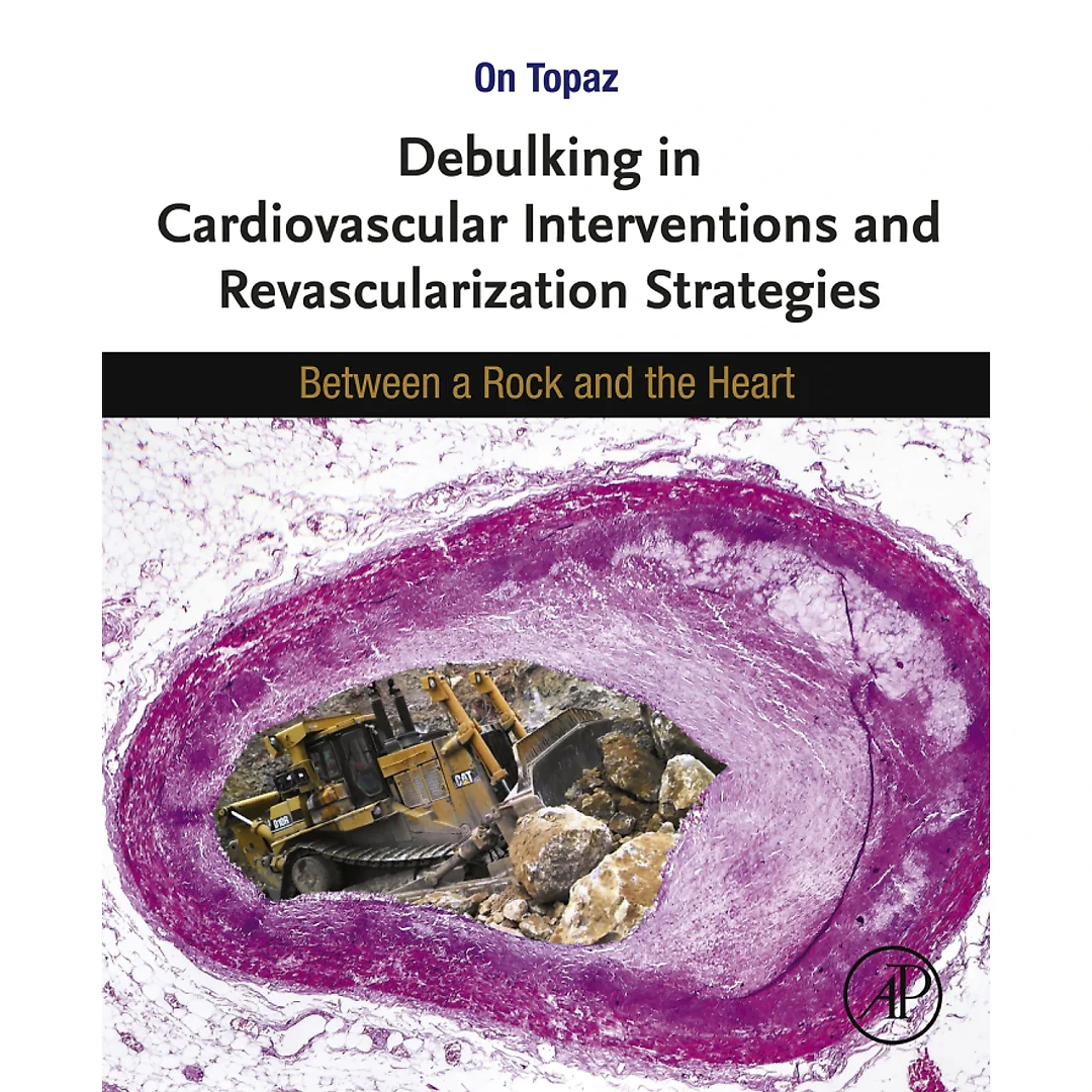 Debulking in Cardiovascular Interventions and Revascularization Strategies : Between a Rock and the Heart