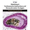 Debulking in Cardiovascular Interventions and Revascularization Strategies : Between a Rock and the Heart