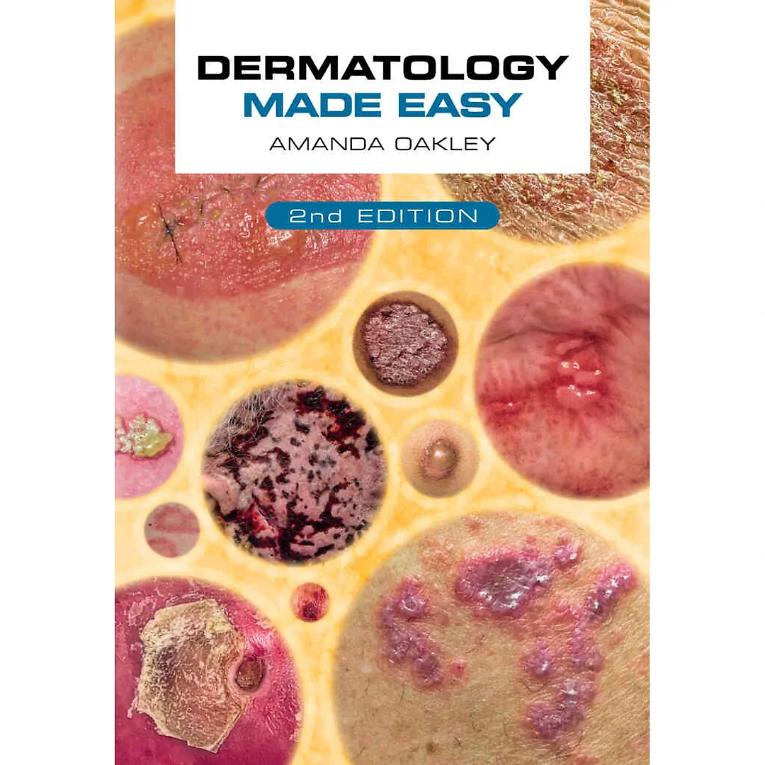 Dermatology Made Easy