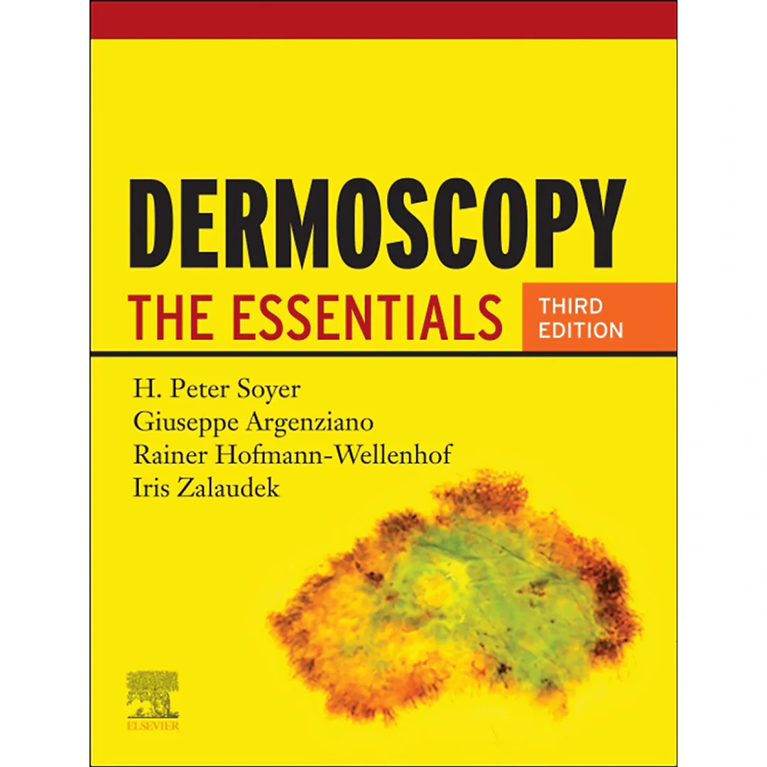 Dermoscopy: The Essentials