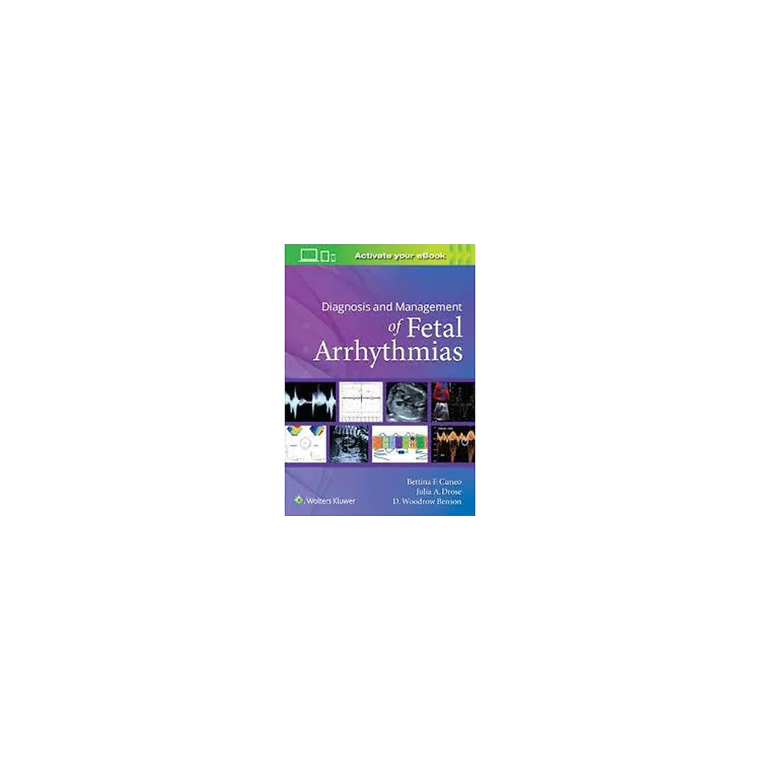 Diagnosis and Management of Fetal Arrhythmias