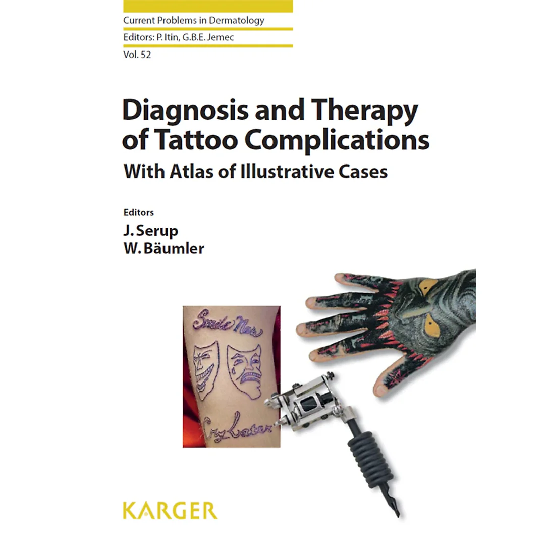 Diagnosis and Therapy of Tattoo Complications: With Atlas of Illustrative Cases