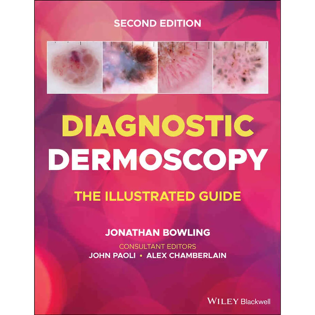 Diagnostic Dermoscopy: The Illustrated Guide