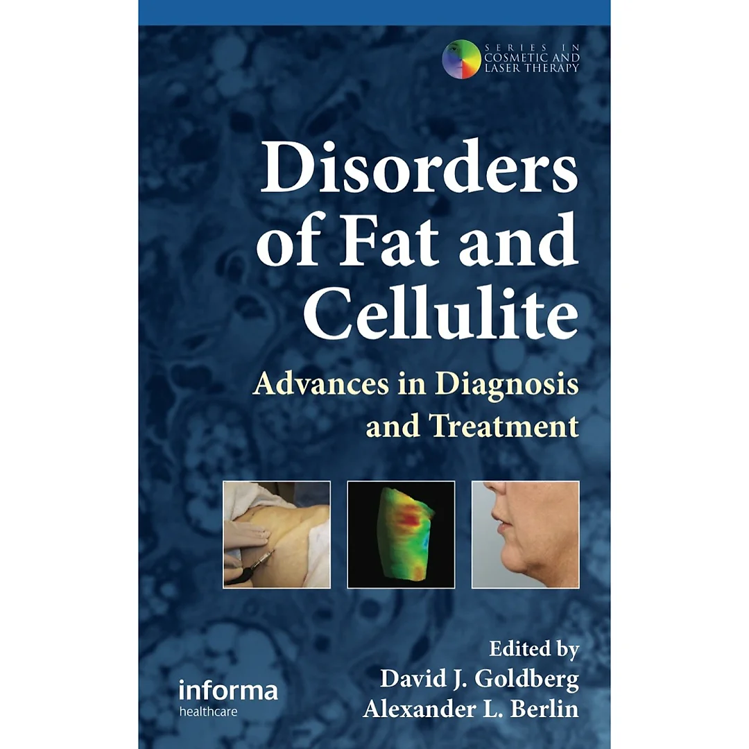 Disorders of Fat and Cellulite: Advances in Diagnosis and Treatment