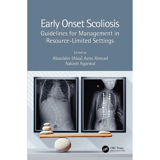 Early Onset Scoliosis: Guidelines for Management in Resource-Limited Settings