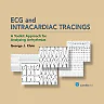 ECG and Intracardiac Tracings: A Toolkit Approach for Analyzing Arrhythmias