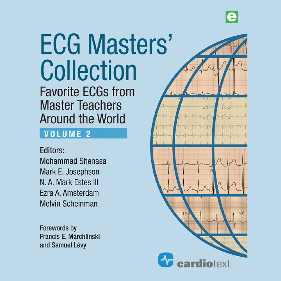 ECG Masters Collection Volume 2: Favorite ECGs from Master Teachers Around the World