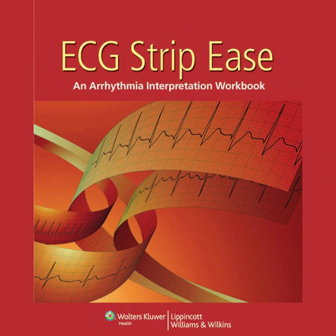 ECG Strip Ease: An Arrhythmia Interpretation Workbook, 1st Edition