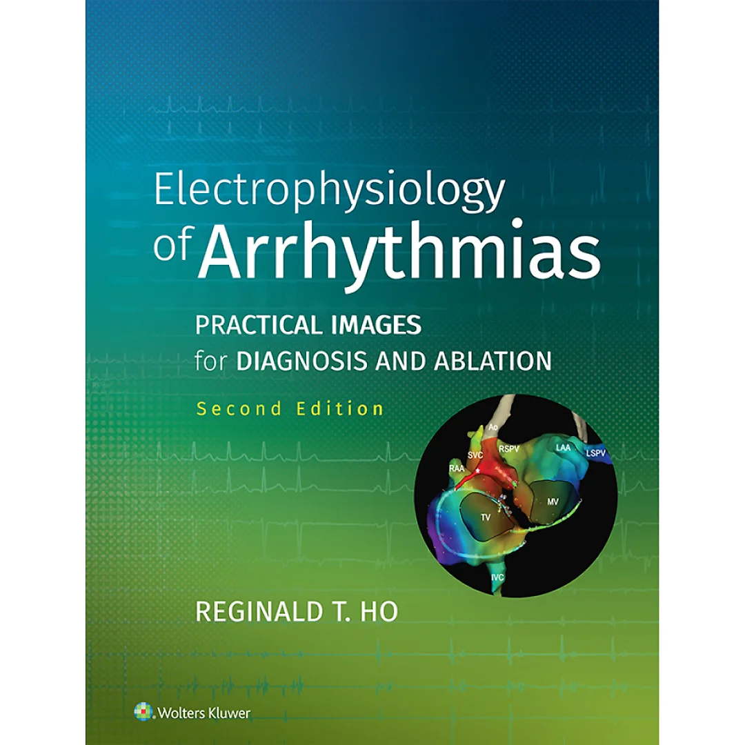 Electrophysiology of Arrhythmias: Practical Images for Diagnosis and Ablation