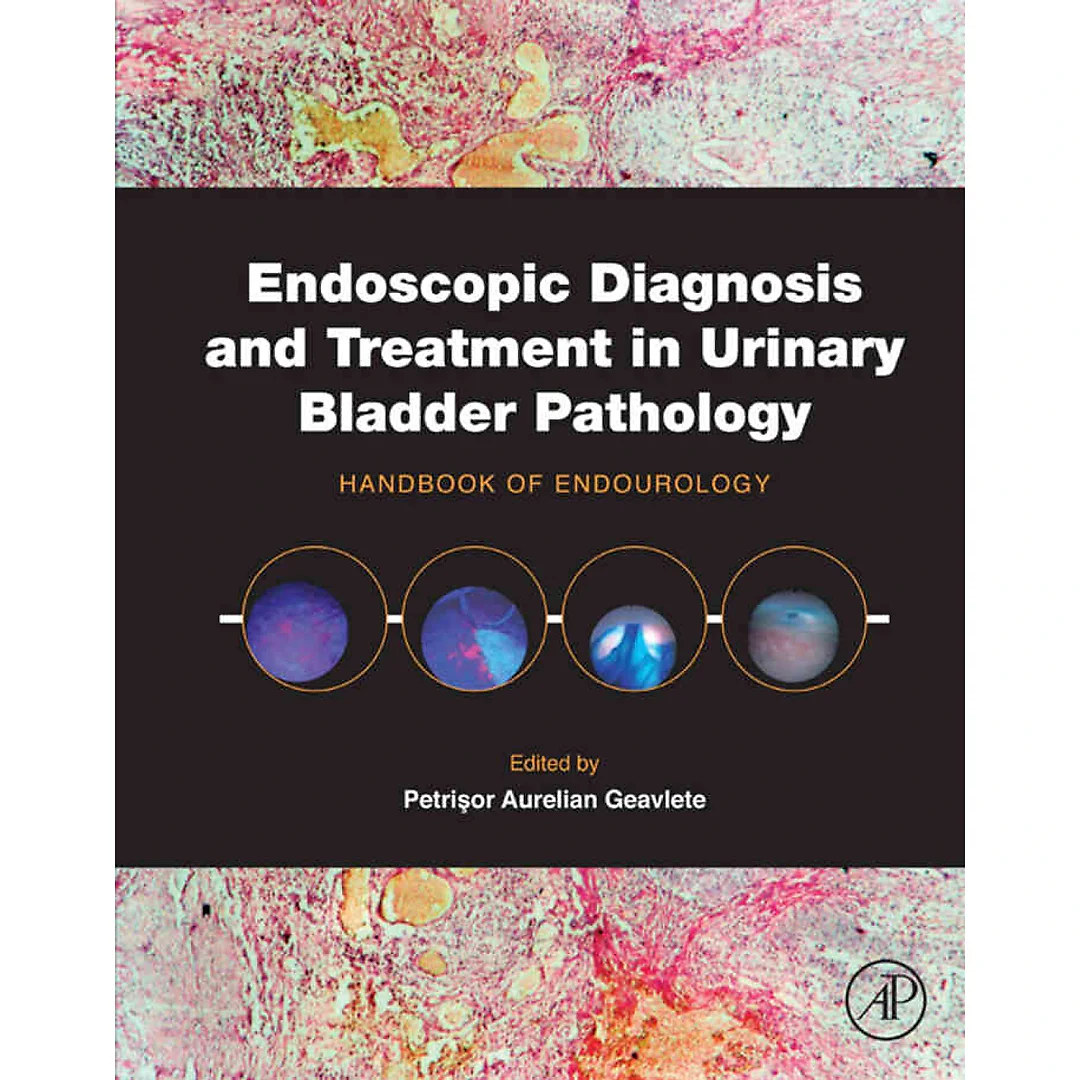 Endoscopic Diagnosis and Treatment in Urinary Bladder Pathology: Handbook of Endourology