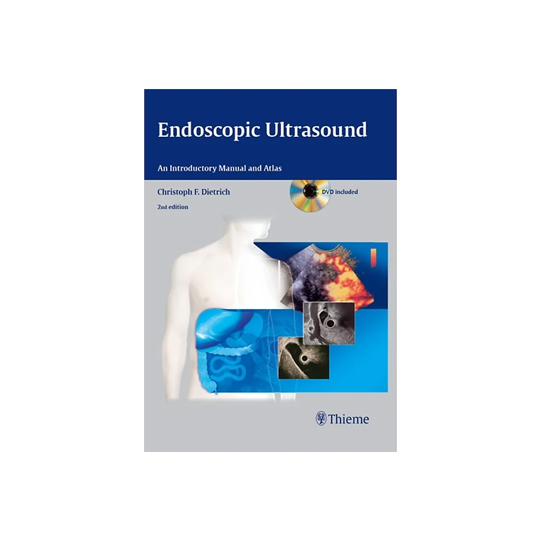 Endoscopic Ultrasound: An Introductory Manual and Atlas