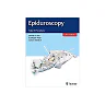 Epiduroscopy