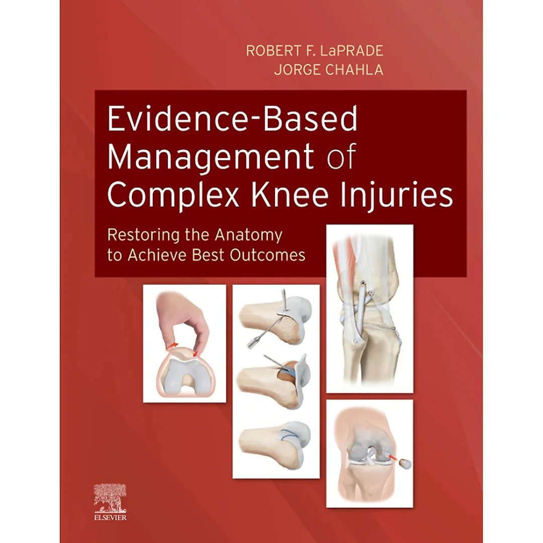 Evidence-Based Management of Complex Knee Injuries: Restoring the Anatomy to Achieve Best Outcomes
