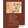 Facial Danger Zones: Avoiding Nerve Injury in Facial Plastic Surgery