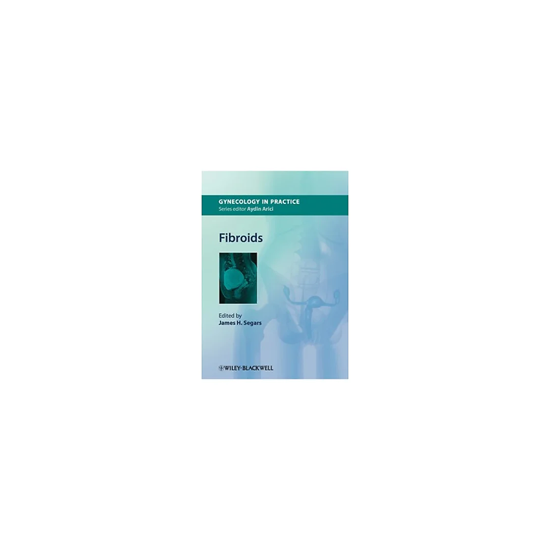 Fibroids