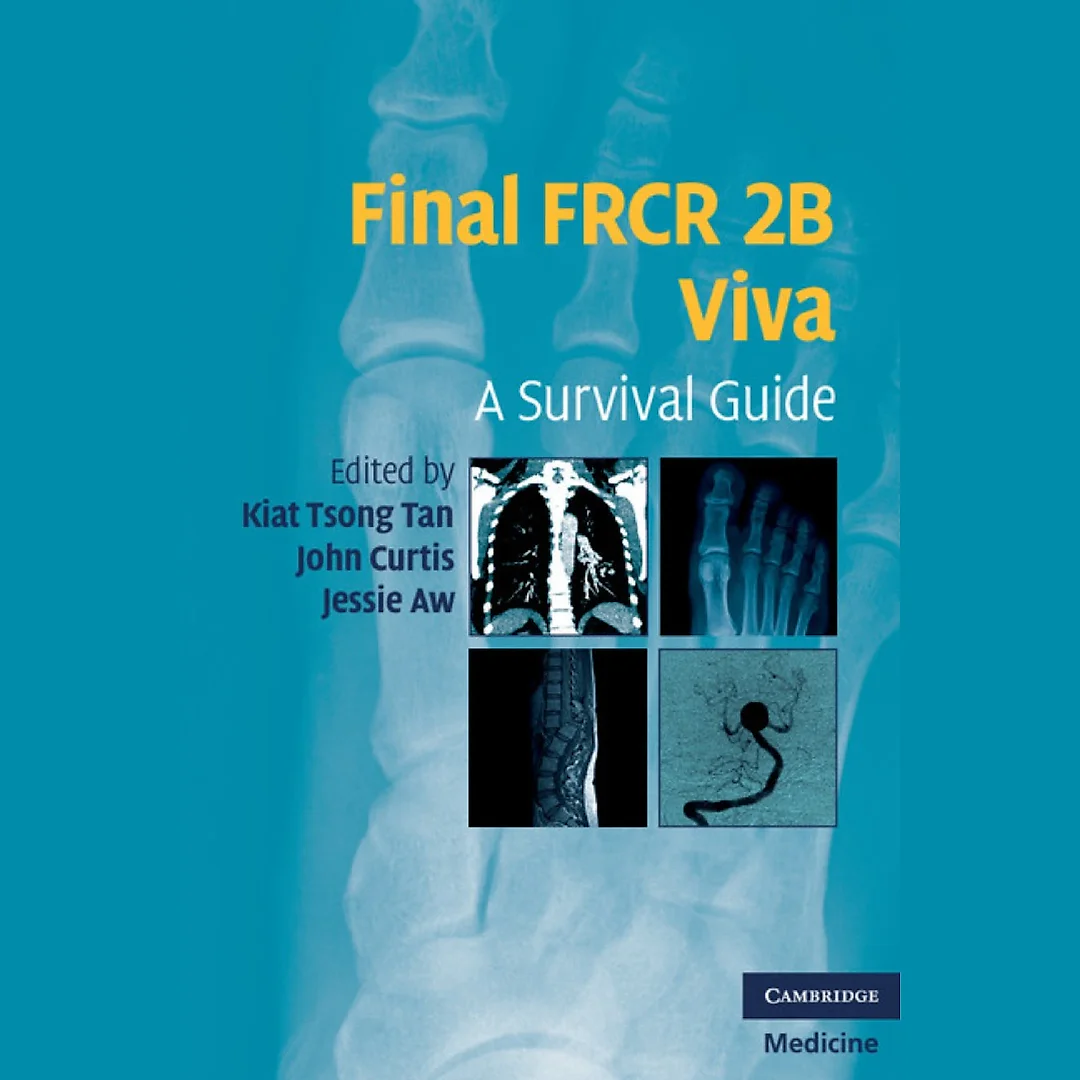 Final FRCR 2B Viva: A Survival Guide