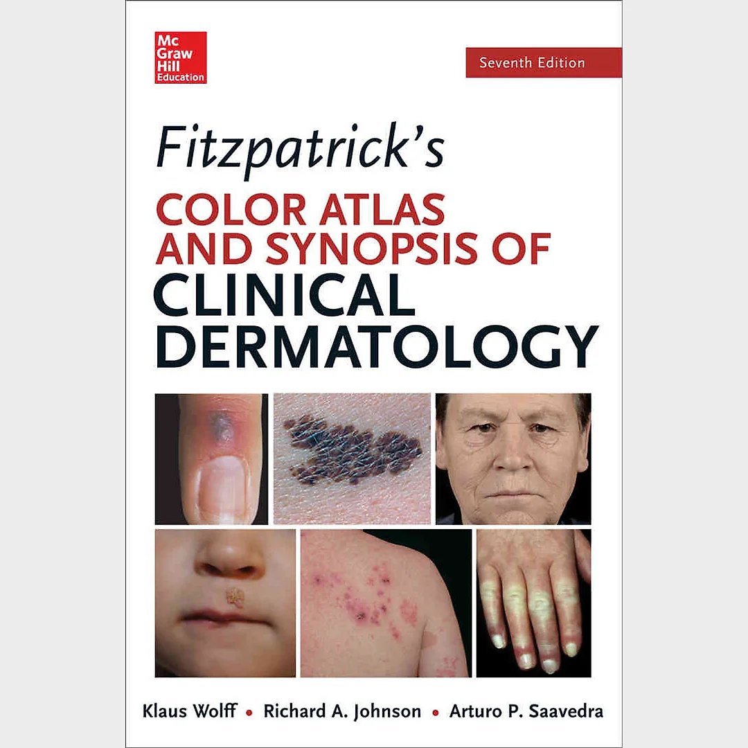 Fitzpatrick's Color Atlas and Synopsis of Clinical Dermatology