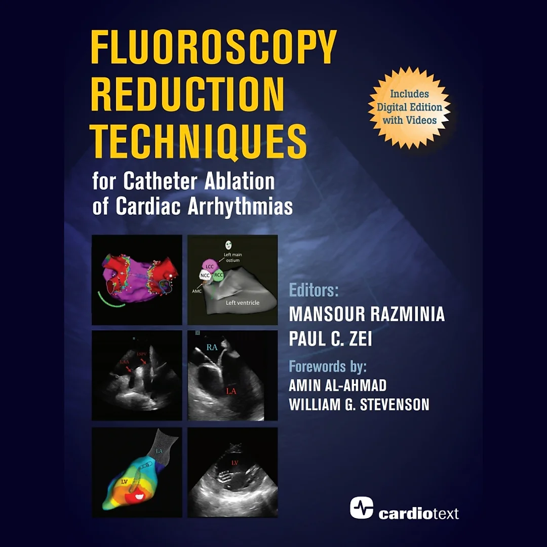 Fluoroscopy Reduction Techniques for Catheter Ablation of Cardiac Arrhythmias