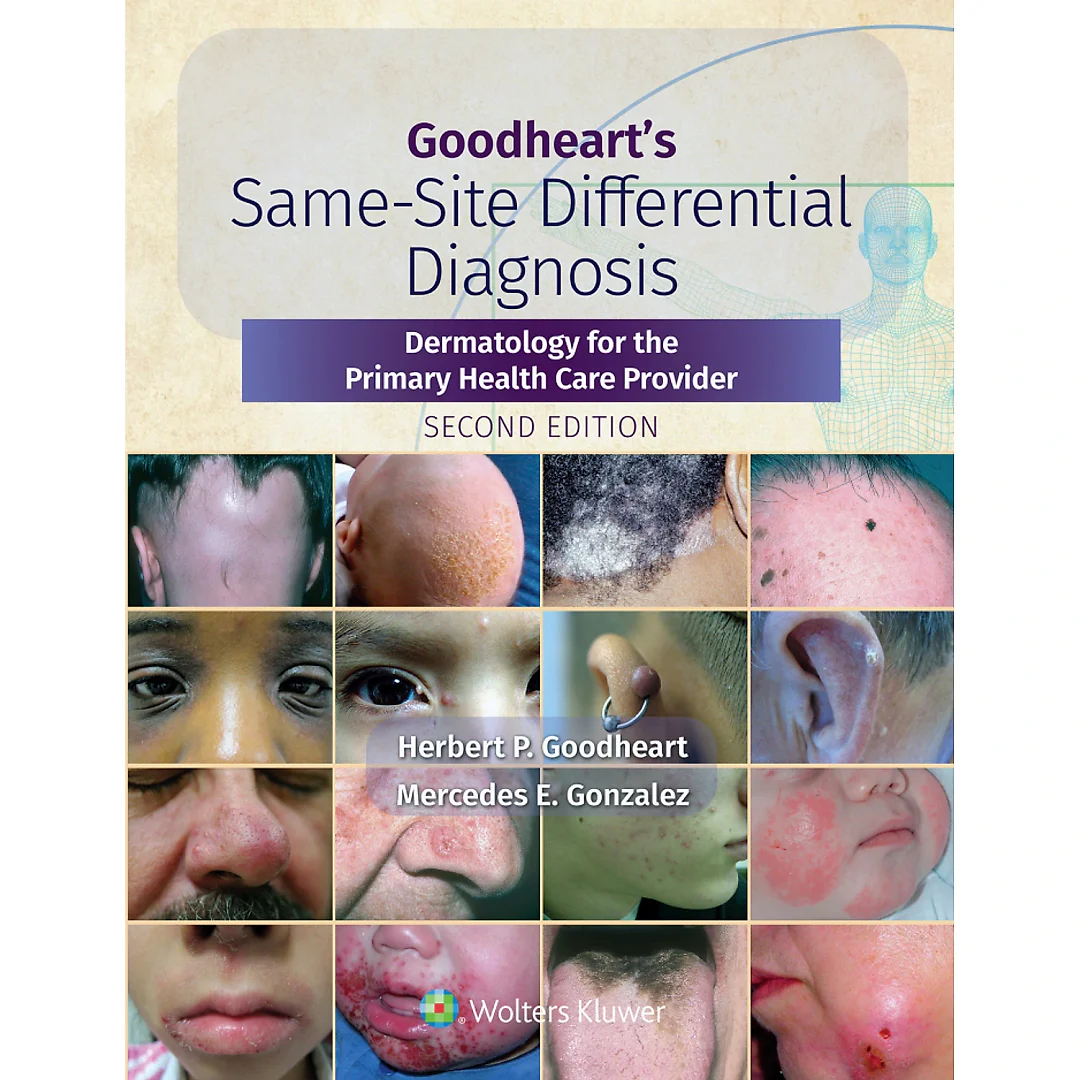 Goodheart's Same-Site Differential Diagnosis: Dermatology for the Primary Health Care Provider