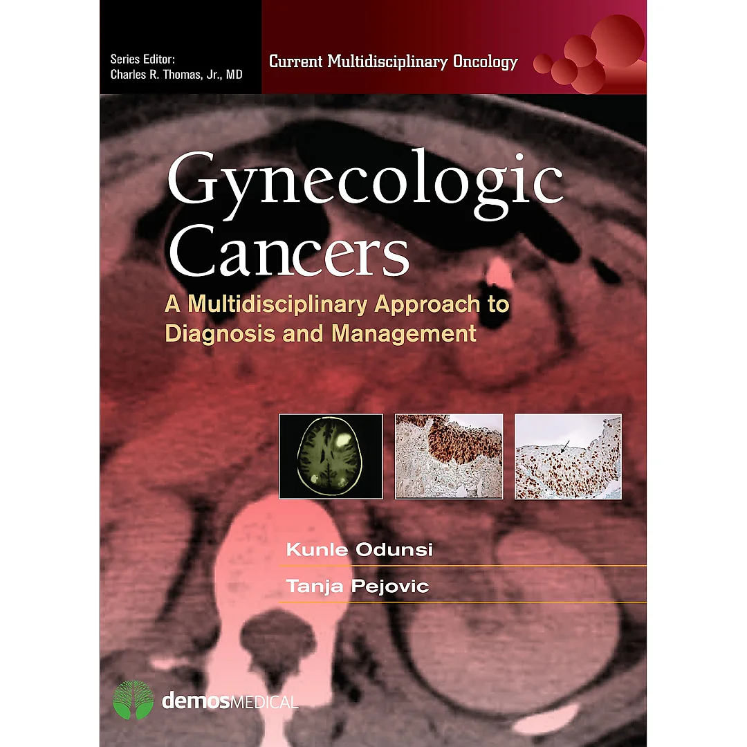 Gynecologic Cancers: A Multidisciplinary Approach to Diagnosis and Management