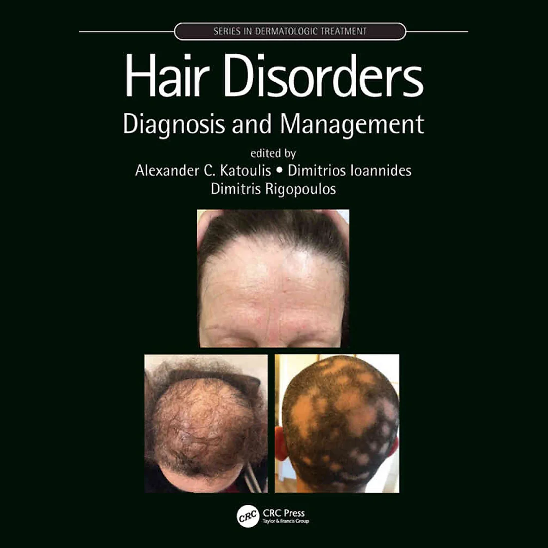 Hair Disorders: Diagnosis and Management