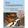 Hair Transplantation