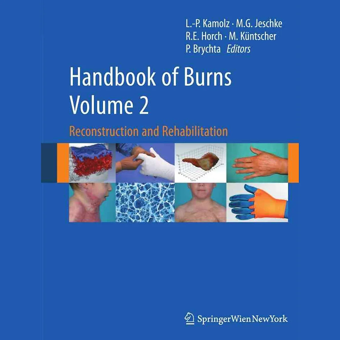 Handbook of Burns Volume 2: Reconstruction and Rehabilitation