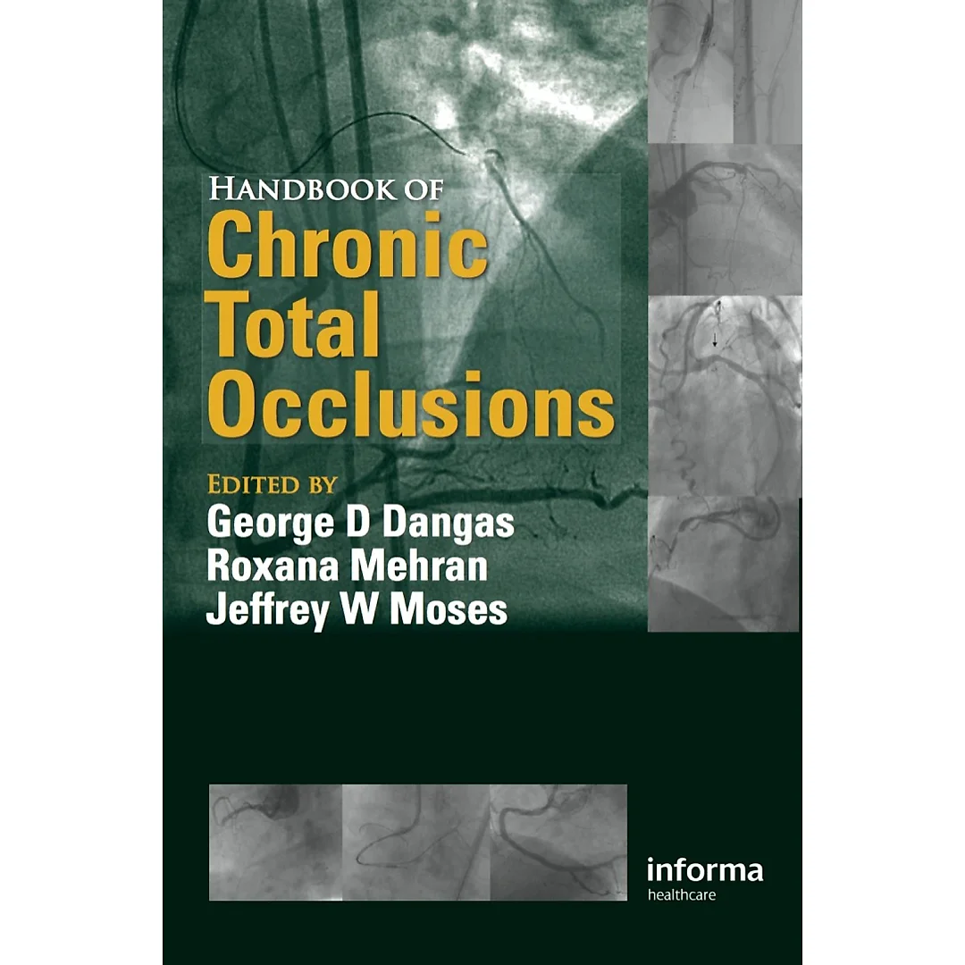 Handbook of Chronic Total Occlusions