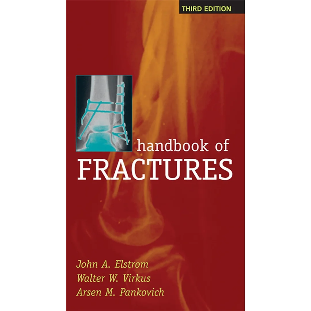 Handbook of Fractures