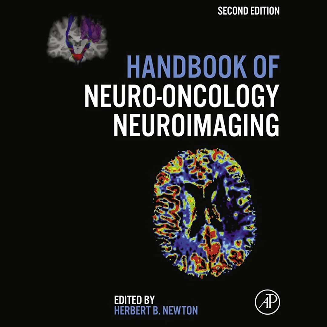 Handbook of Neuro-Oncology Neuroimaging