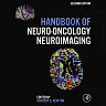 Handbook of Neuro-Oncology Neuroimaging
