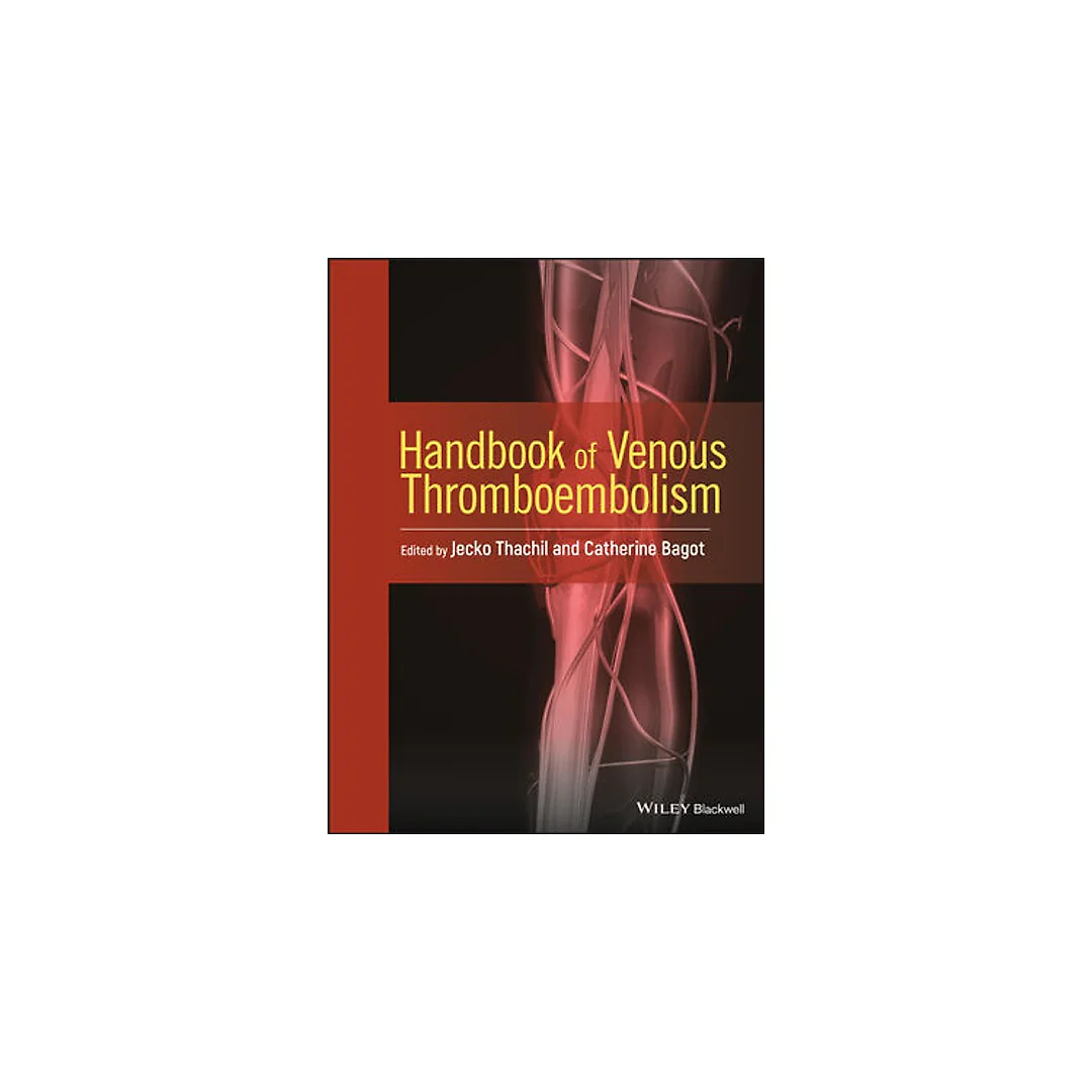 Handbook of Venous Thromboembolism