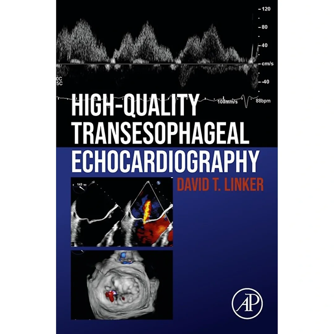 High-Quality Transesophageal Echocardiography