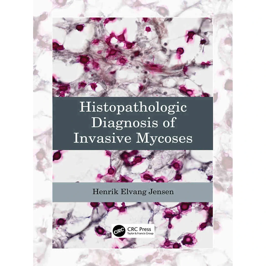 Histopathologic Diagnosis of Invasive Mycoses
