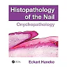 Histopathology of the Nail: Onychopathology