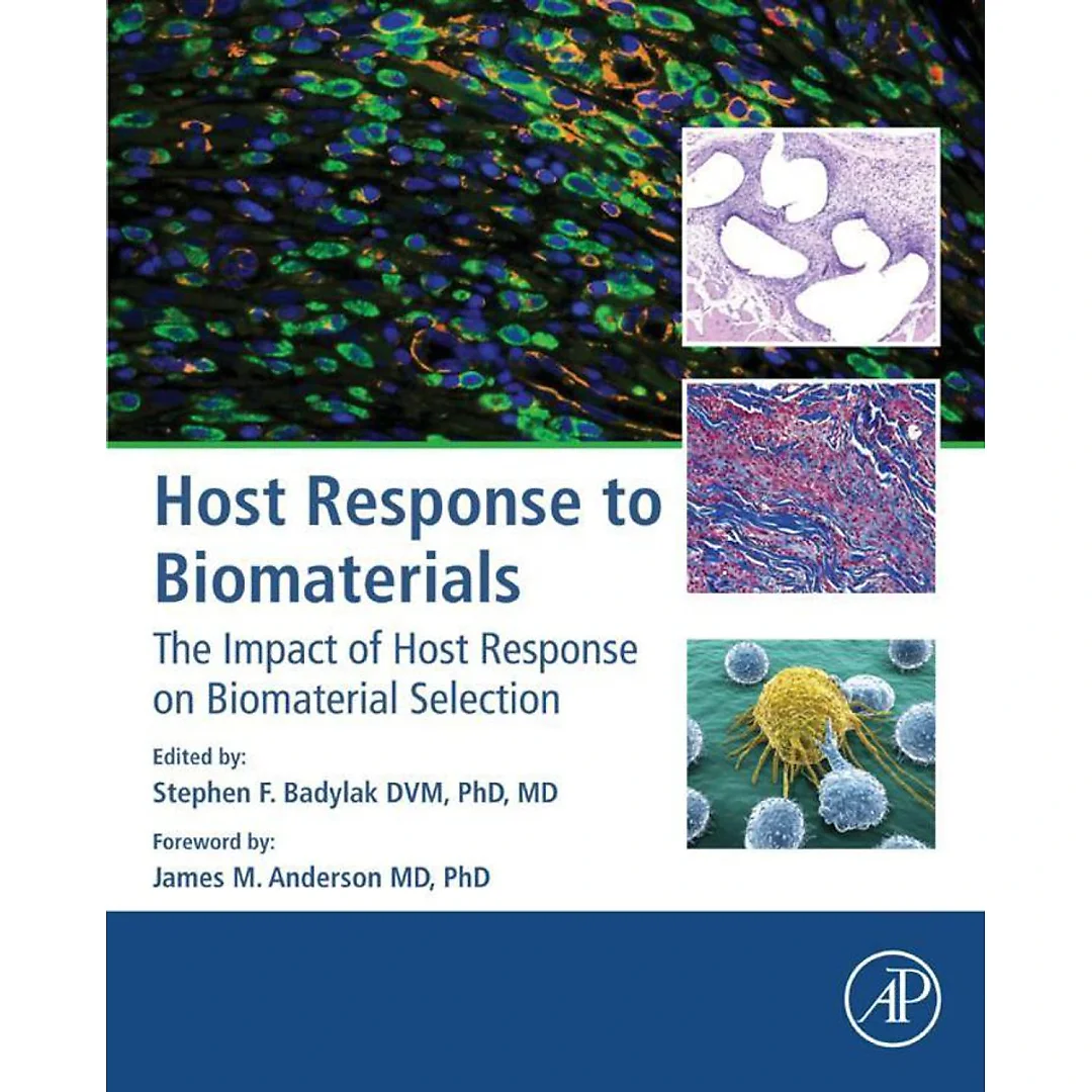 Host Response to Biomaterials: The Impact of Host Response on Biomaterial Selection