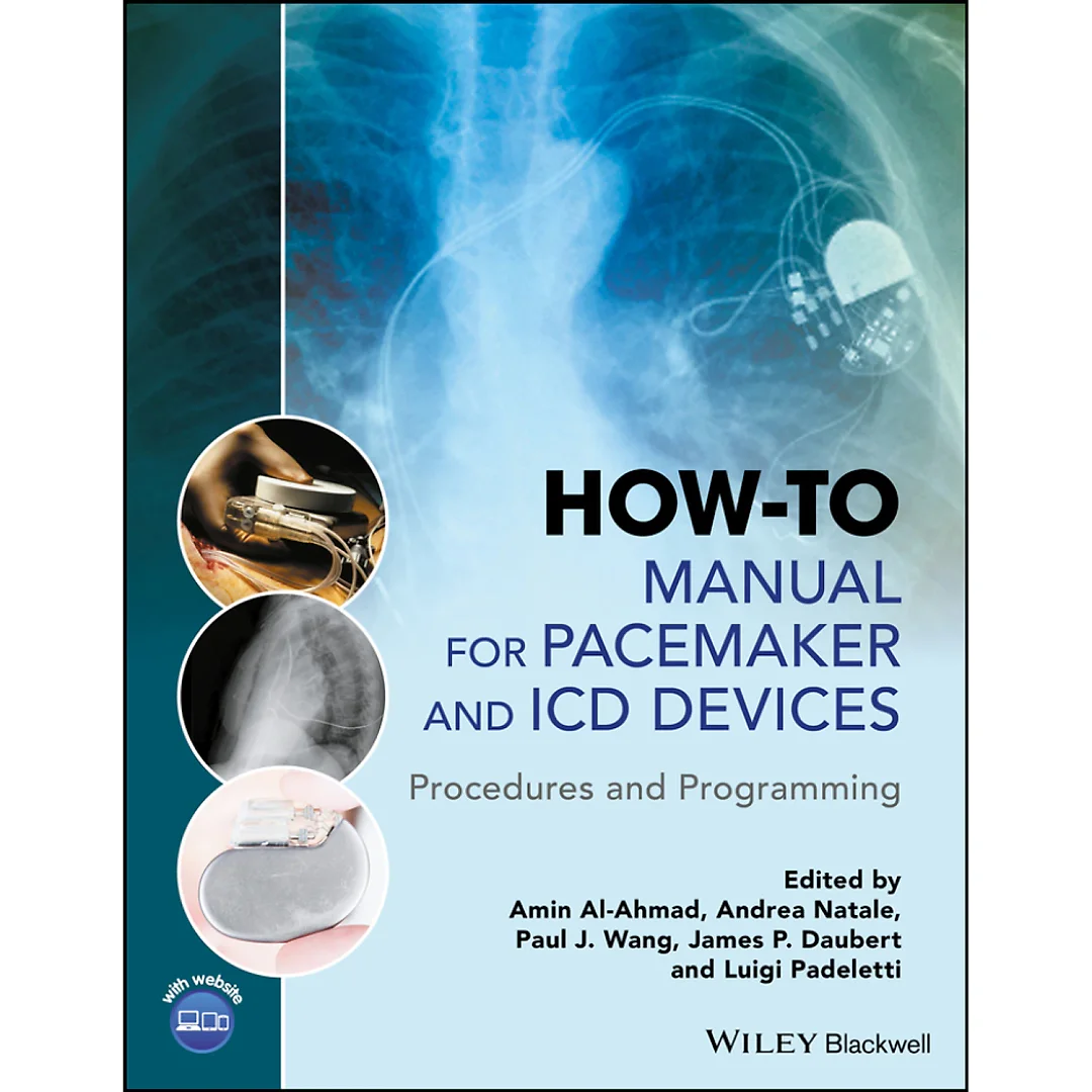 How-to Manual for Pacemaker and ICD Devices: Procedures and Programming