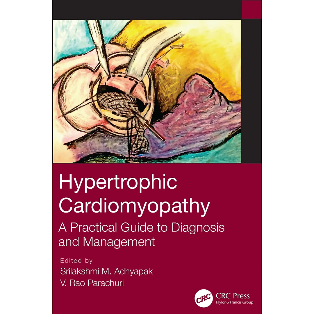 Hypertrophic Cardiomyopathy: A Practical Guide to Diagnosis and Management