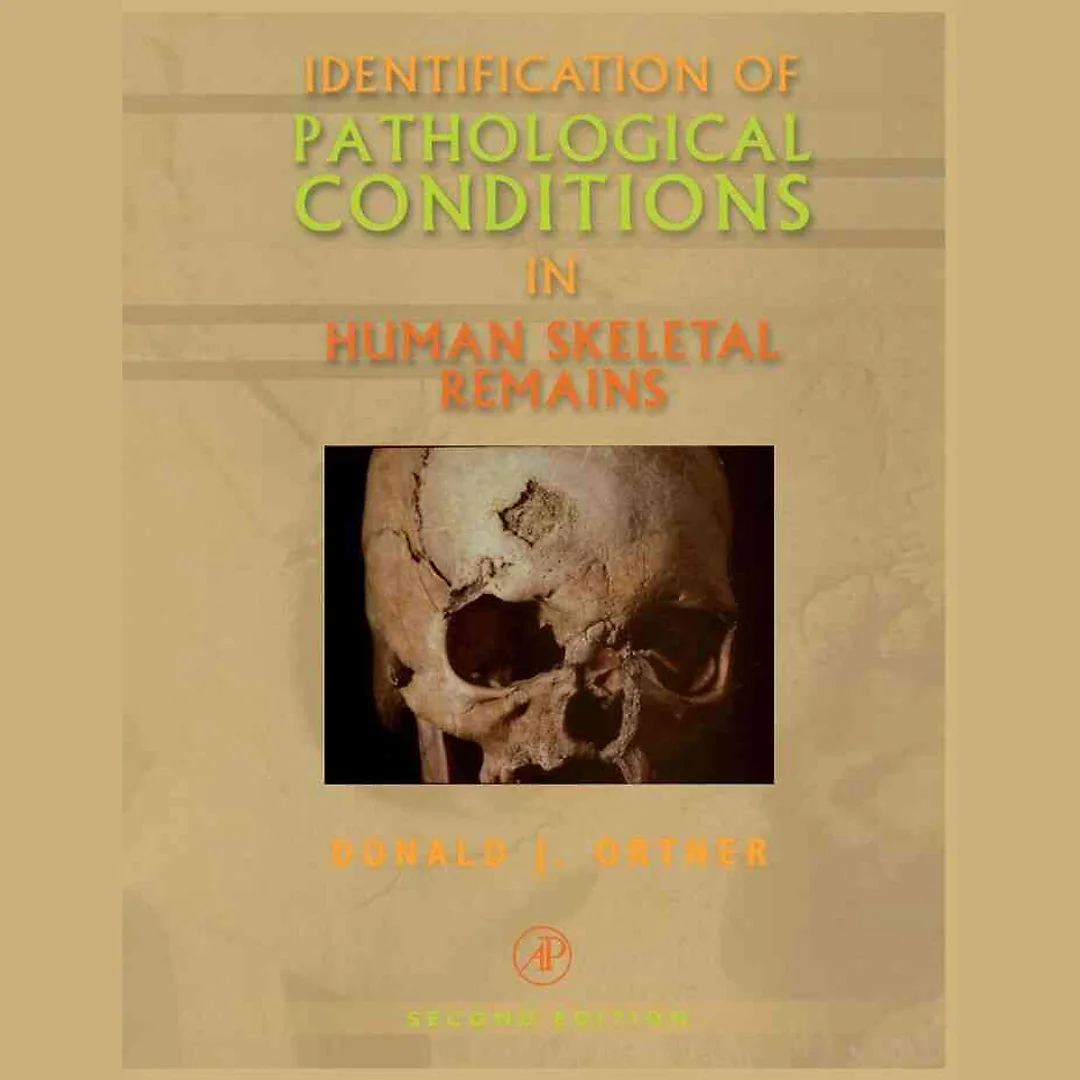 Identification of Patholog in Human Skeletal Remains
