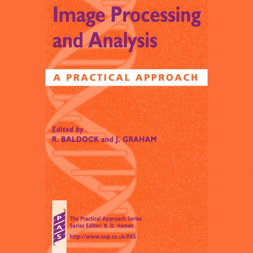 Image Processing and Analysis: A Practical Approach