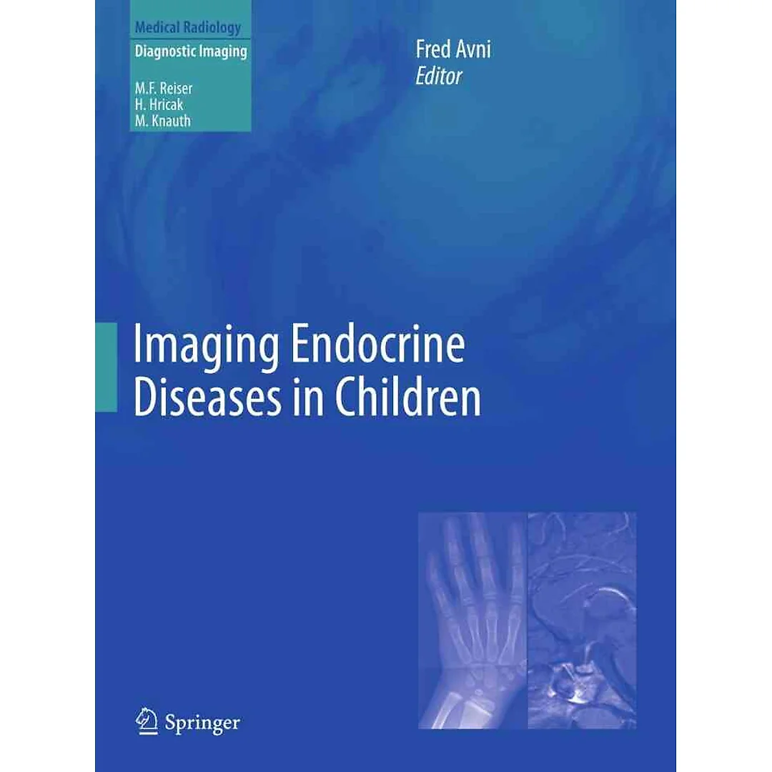 Imaging Endocrine Diseases in Children