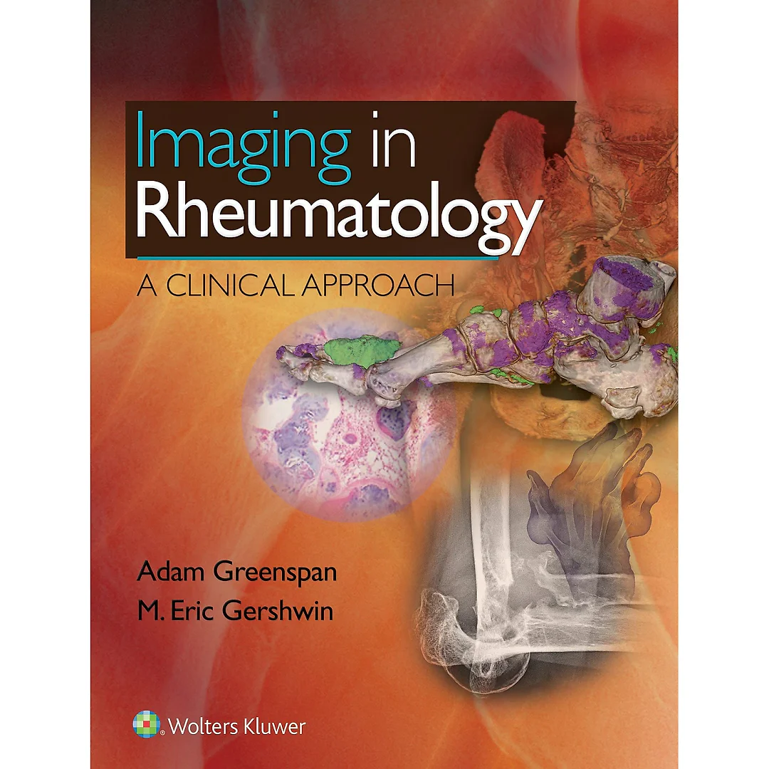 Imaging in Rheumatology: A Clinical Approach