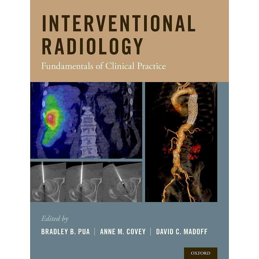 Interventional Radiology: Fundamentals of Clinical Practice
