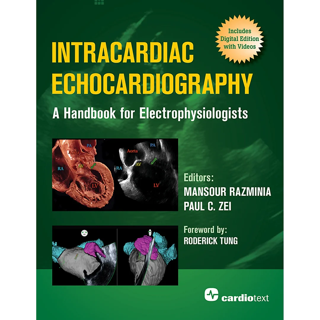 Intracardiac Echocardiography: A Handbook for Electrophysiologists
