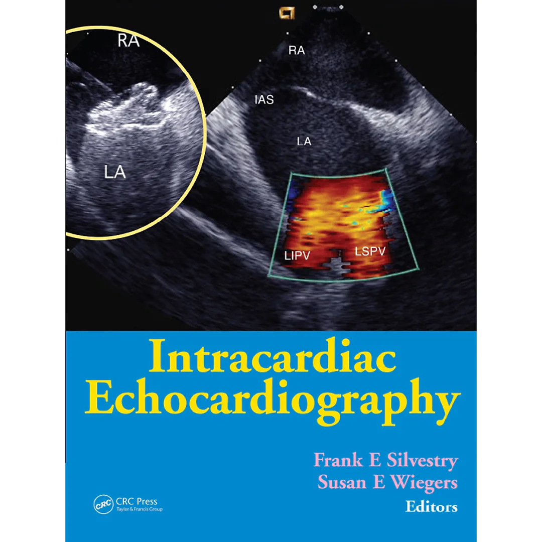Intracardiac Echocardiography