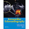 Intracardiac Echocardiography